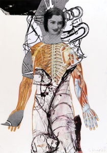 Stefan Voigt / Testsession 04 / Siebdruck, Montage a. Anatomie-Schautafel (Papier) / 118 x 84 cm / 2004